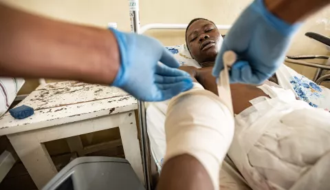 epa11850521 A victim of fighting between the M23 rebels and the Armed forces of the Democratic Republic of Congo (FARDC) is attended to in Cbeca Ndosho hospital in Goma, North Kivu province, Democratic Republic of Congo, 24 January 2025. A Congolese military governor was killed by rebels from the Rwanda-backed M23, as confirmed by an army spokesperson. EPA/NADAA KAHASHY