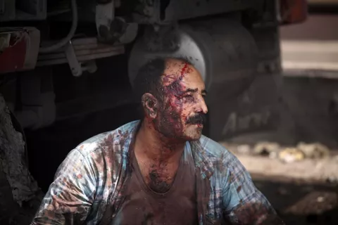epa12056412 GRAPHIC CONTENT - An injured worker rests near the site of an explosion at the Rajaie port in the city of Bandar Abbas, southern Iran, 26 April 2025. Iranian state media reported on 26 April several injuries in an explosion at the port, but authorities have not yet announced the cause. EPA/Mohammad Rasoul Moradi -- ATTENTION EDITORS: GRAPHIC CONTENT --