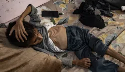 epaselect epa12137109 Five-year-old Palestinian child Osama al-Raqab, who is suffering from severe malnutrition receives treatment at Nasser Hospital in Khan Yunis, southern Gaza Strip, 26 May 2025. EPA/HAITHAM IMAD