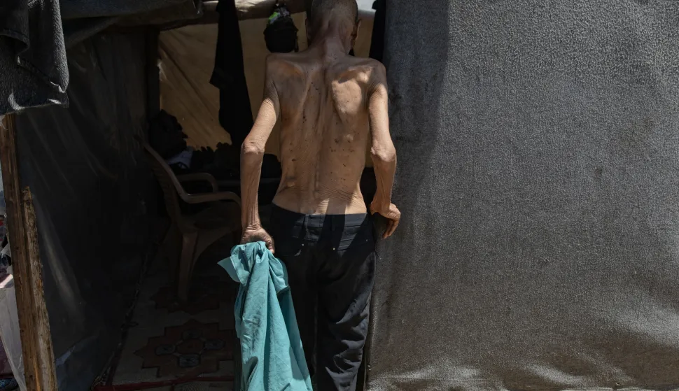 epa12281891 Internally displaced elderly Palestinian man Salim Asfour, enters his family's tent in Khan Younis, southern Gaza Strip, 03 August 2025. Salim, 85, suffers from severe malnutrition, which in recent months has led to the loss of over 40 kilograms of his body weight. When food is available, Salim gives most of his rations to his family, and his advanced age makes him more vulnerable to the effects of malnutrition. More than 170 Palestinians, the majority of whom children, have died of malnutrition in Gaza since Israel blocked all supplies from entering the Strip in March 2025, the Palestinian Ministry of Health said on 03 August. EPA/HAITHAM IMAD