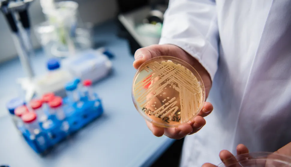 The director of the National Reference Centre for Invasive Fungus Infections, Oliver Kurzai, holding in his hands a petri dish holding the yeast candida auris in a laboratory of Wuerzburg University in Wuerzburg, Germany, 23 January 2018. There has been a recent rise of cases in Germany of seriously ill patients becoming infected with the dangerous yeast candida auris. Photo: Nicolas Armer/dpa /DPA/PIXSELL