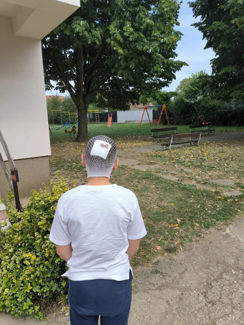 Dvije razbijene glave i krv, 14-godišnjak naletio na dijete (10)