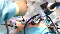 Čepin, 18 02. 2026., Čepin, Priora, International Medical Center, operacija, operaciona sala, pacijenti,operacija; bolnica; ilustracijaSNIMIO BRUNO JOBST