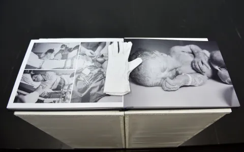 Snaga, ranjivost i čudo života u najči&scaron;ćem obliku