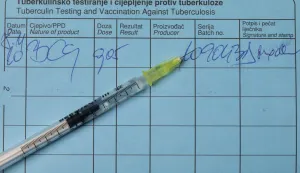 04.05.2022., Zagreb - Ilustracija - tuberkuloza.Photo: Davor Puklavec/PIXSELL Photo: Davor Puklavec/PIXSELL