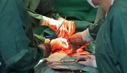 05.09.2014., Zagreb - Transplantacijski tim KB Merkur. Photo: Jurica Galoic/PIXSELL"n