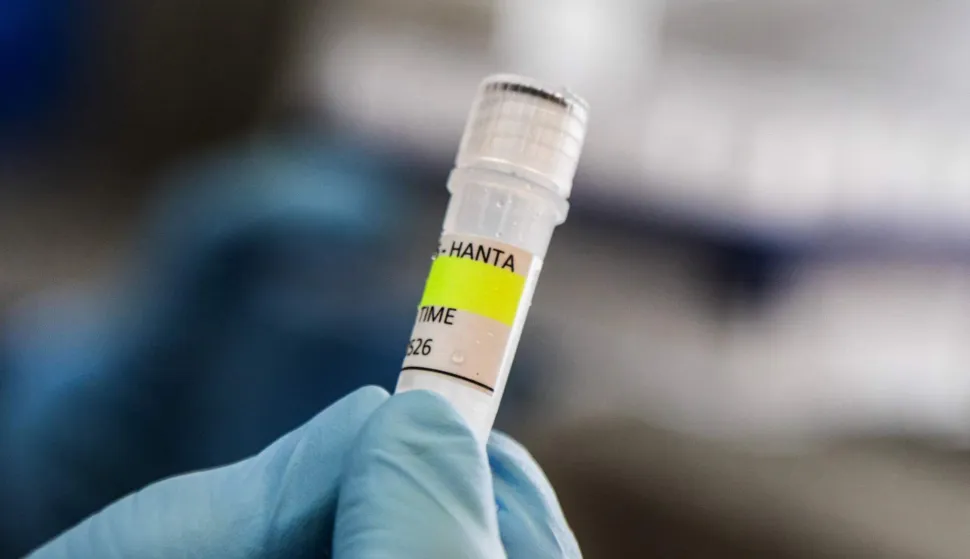 This handout picture released by Argentina's Health Ministry shows a scientist from the Malbr?n Institute holding a container used to diagnose the Andes hantavirus, which contains RNA from the Andes virus as part of the detection process, in Buenos Aires on May 6, 2026. Argentina has seen an increase in hantavirus cases but not an outbreak, an expert told AFP on May 6, as infections aboard a cruise ship have provoked a global health scare. The MV Hondius set sail from Ushuaia in southern Argentina on April 1 and is currently anchored off the coast of Cape Verde after three passengers died, possibly of hantavirus. (Photo by Handout/ARGENTINE HEALTH MINISTRY/AFP)/XGTY/RESTRICTED TO EDITORIAL USE - MANDATORY CREDIT "AFP PHOTO /Argentina's Health Ministry" - NO MARKETING NO ADVERTISING CAMPAIGNS - DISTRIBUTED AS A SERVICE TO CLIENTS
